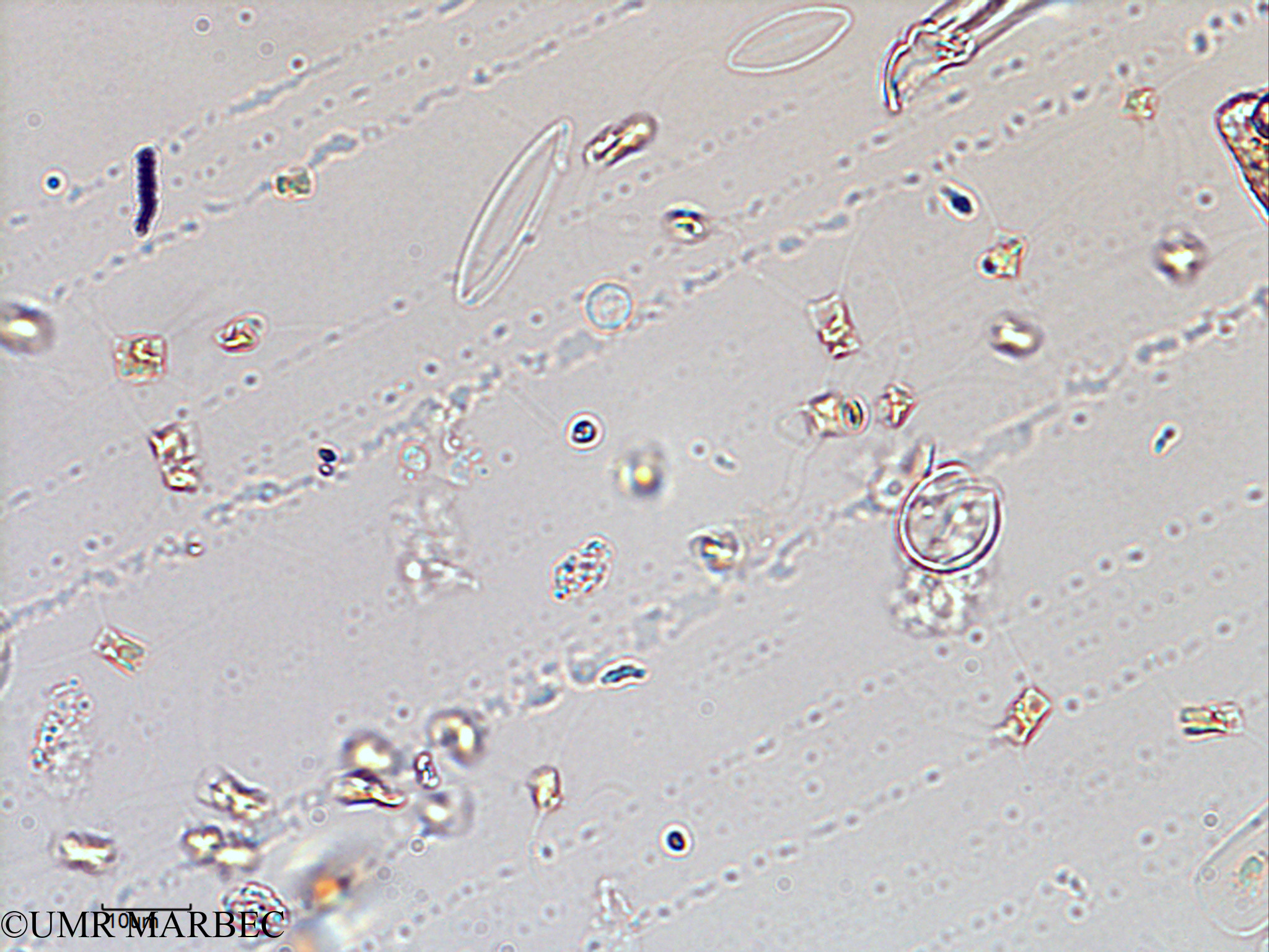 phyto/Scattered_Islands/juan_de_nova/COMMA2 November 2013/Chaetoceros tenuissimus (ancien Chaetoceros sp unicellulaire-2).tif(copy).jpg